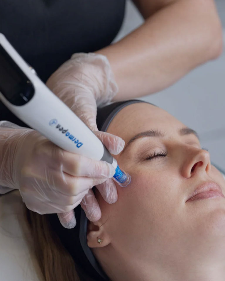 Dermapen